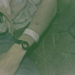 Kurt Cobain's arm showing his medical bracelet from a drug rehab center in LA