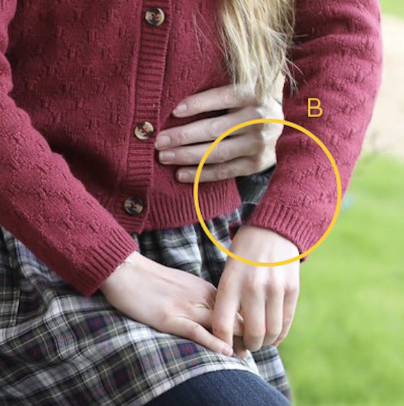 The triangle of space between Charlotte’s arm and her torso is extremely distorted!